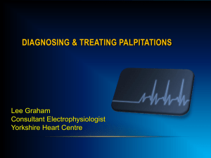 Palpitations in general practice