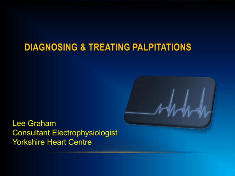 palpitations-in-general-practice