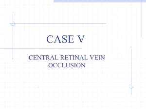Central Retinal Vein Occlusion (Powerpoint)