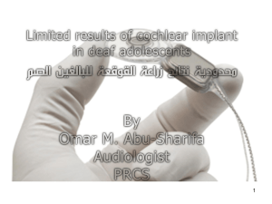 زراعة القوقعه Cochlear implant