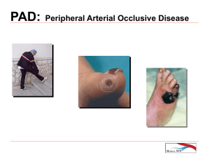 PAD: Peripheral Arterial Occlusive Disease