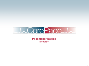 CorePace #5 - Pacemaker Basics