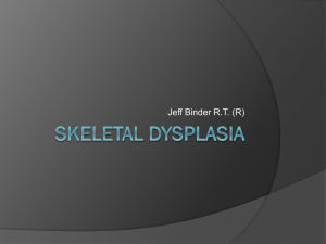 Skeletal Dysplasias ppt