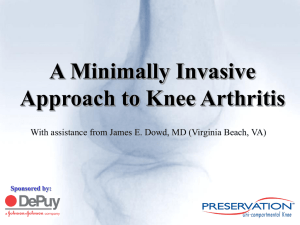 A Minimally Invasive Approach to Knee Arthritis Sponsored by