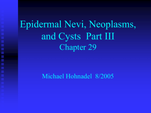 Andrew`s Diseases of the Skin Epidermal Nevi, Neoplasms