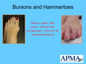 Bunions and Hammertoes