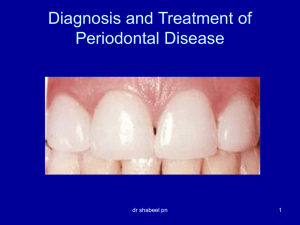 STAGES OF GINGIVITIS AND PERIODONTAL DISEASE