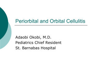 Periorbital and Orbital Cellulitis