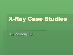 X-Ray Case Studies