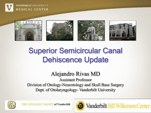 Superior Semicircular Canal Dehiscence