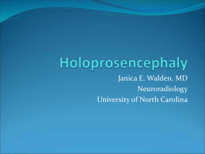 Holoprosencephaly (FILEminimizer)