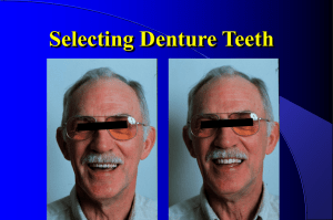 Selecting and Setting Denture Teeth