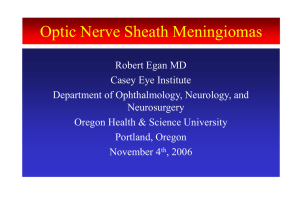 Parasellar and optic nerve sheath meningiomas