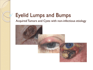 Eyelid Lumps and Bumps