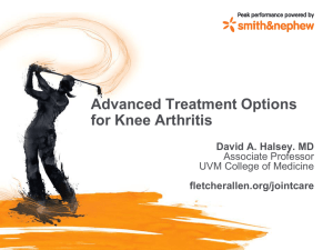 Advanced Treatments for Knee Arthritis (Smith and