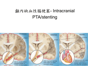 顱內缺血性腦梗塞- Intracranial PTA/stenting