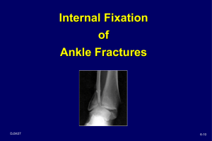 INTERNAL FIXATION OF FOOT AND ANKLE FRACTURES
