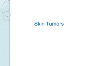 skin tumour