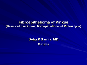 Fibroepithelioma of Pinkus