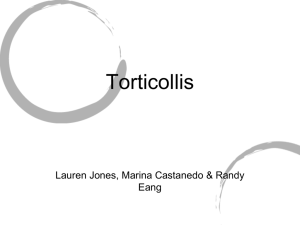 Torticollis Presentation