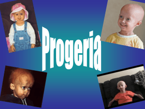 Progeria - shsbiogeneticdisorders