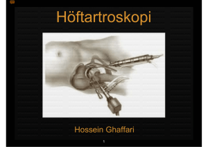 Höftartroskopi - Oslo universitetssykehus