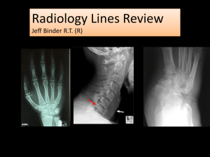 Rad Lines review ppt (updated 5/31/12)