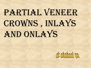 Partial Veneer Crowns , Inlays and Onlays
