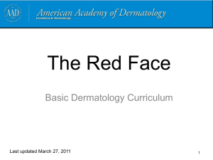 The red face - American Academy of Dermatology