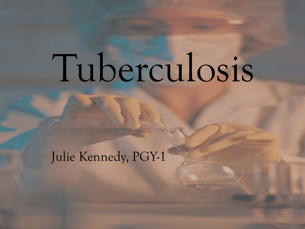 seminar presentation on tuberculosis