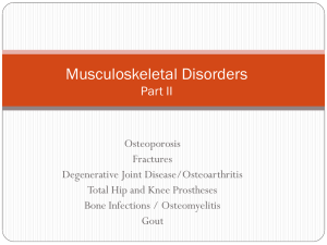 Musculoskeletal Disorders Part II Final
