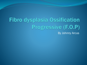 Fibrodysplasia Ossification Progressive (F
