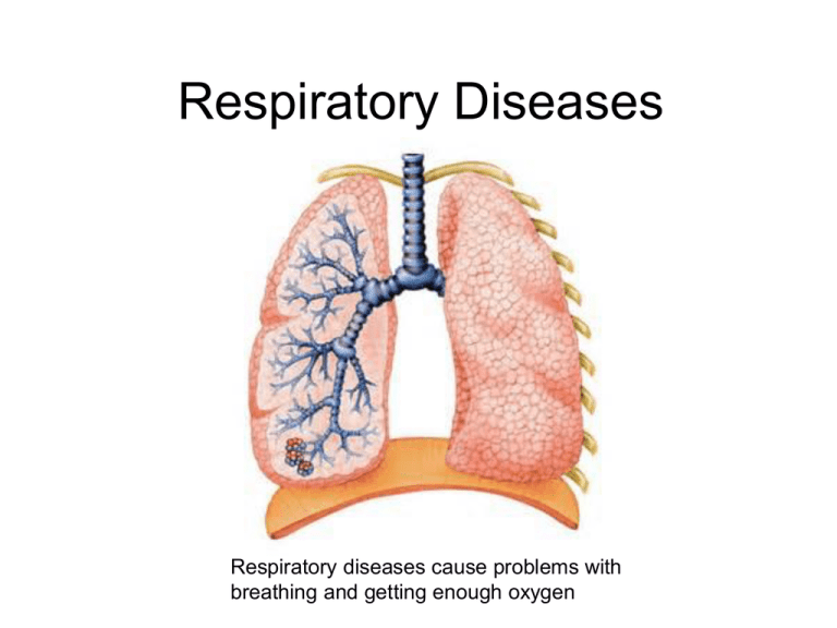 three-main-types-of-lung-disease-powerpoint