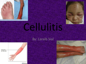 Cellulitis Powerpoint-Laraib