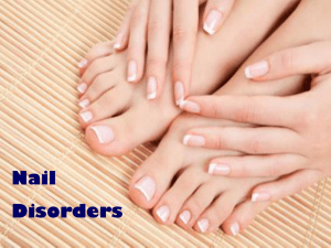 nail disorder