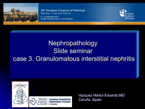 Granulomatous interstitial nephritis_Slide Seminar (PPT / 11335 KB)