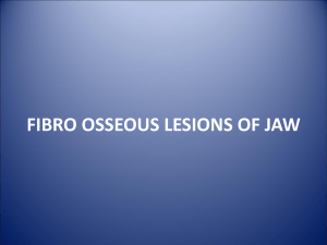 FIBRO OSSEOUS LESIONS OF JAW