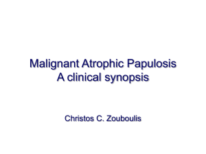 Malignant Atrophic Papulosis