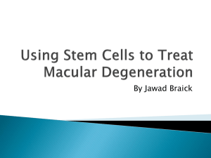 Using Stem Cells to Treat Macular Degeneration - bli