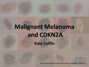 File - Malignant Melanoma / CDKN2A
