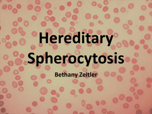File - Hereditary Spherocytosis