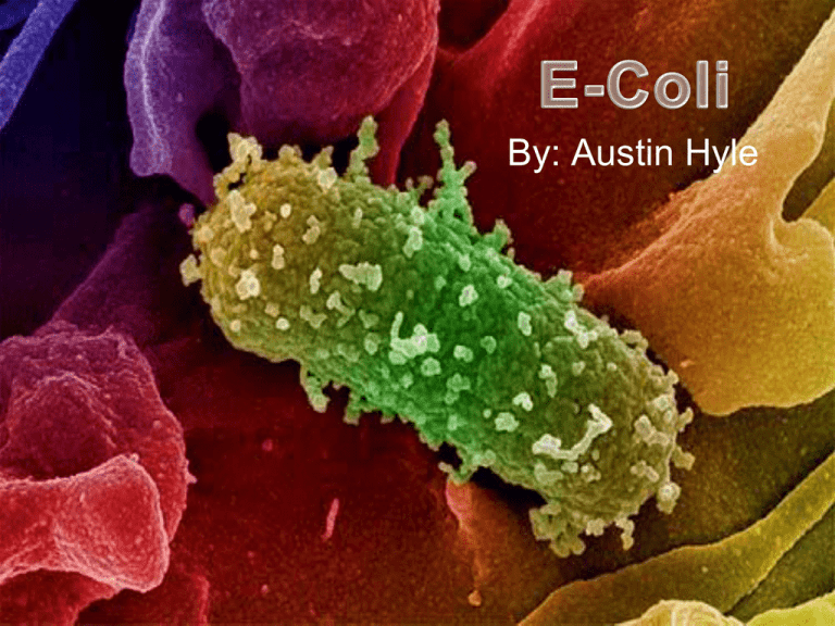 e-coli-sohs