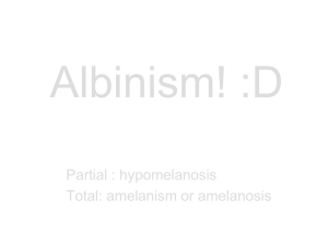 Albinism! :D - trefzclasses