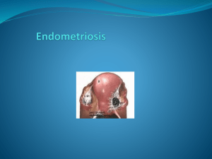 Endometriosis * Recent classification & Modern management