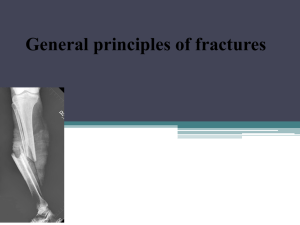 General principles of fractures