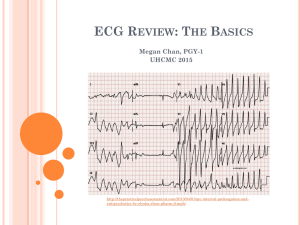 ECG Review: The Basics
