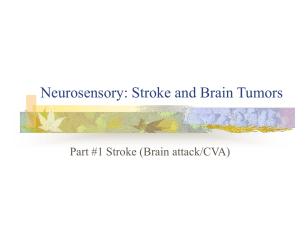 Neurosensory: Herniated Disk and Spinal Cord tumors