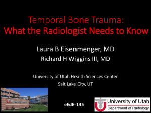 Temporal Bone Trauma: Normal anatomy