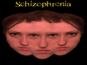 Schizophrenia - Cloudfront.net