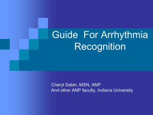 Guide For Arrhythmia Recognition